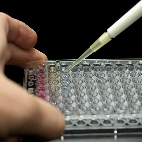 Free Triiodothyronine (Free T3)