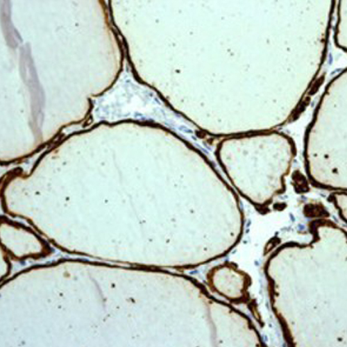 Thyroid Peroxidase Antibody (TPO)