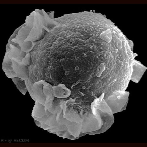 Epstein-Barr Virus (EBV) Antibodies to Early Antigen, IgG