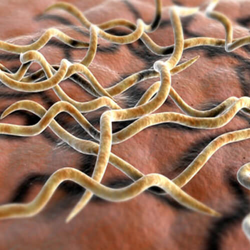 Lyme Disease A/b Quantitative IgM