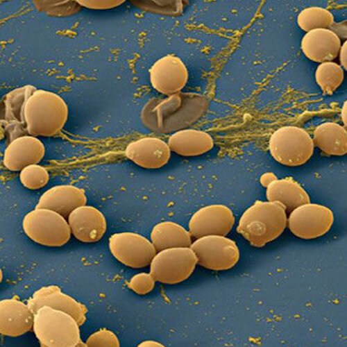 Candida virus A/b IgG