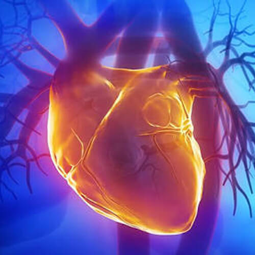Homocysteine, Plasma