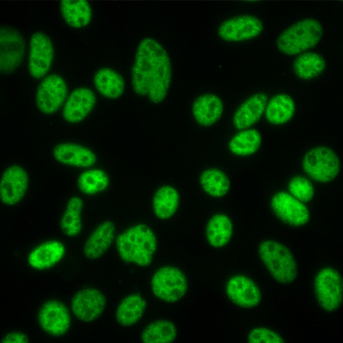 Antinuclear Antibody (ANA)