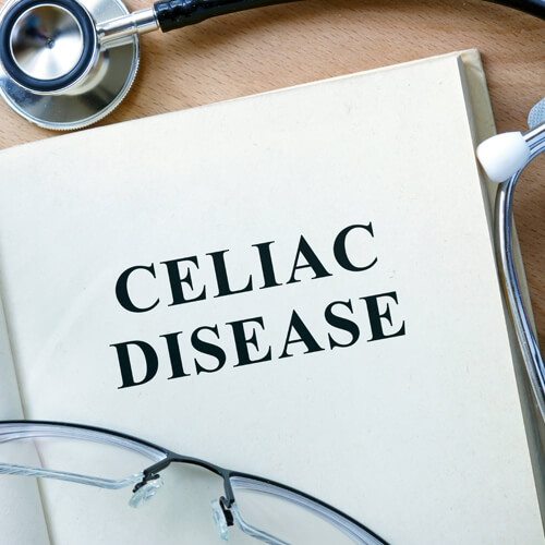Celiac Disease A/B Screen