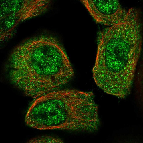Cancer Antigen 125 (CA 125)