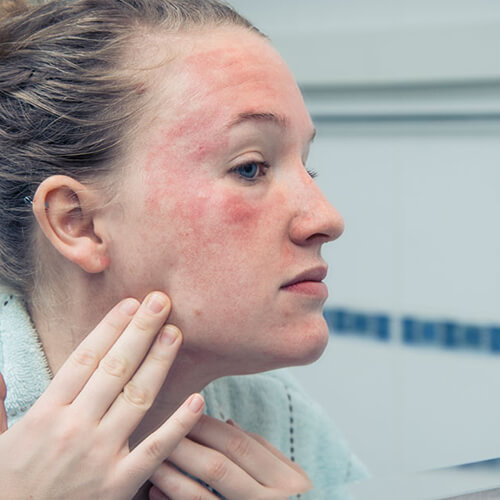 Fribromyalgia Health Screen Check Up