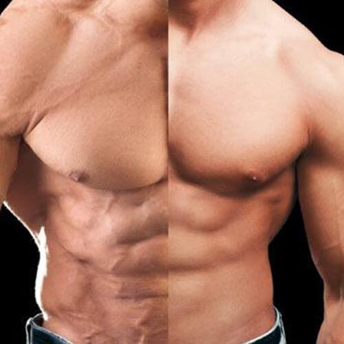 Testosterone Total Test