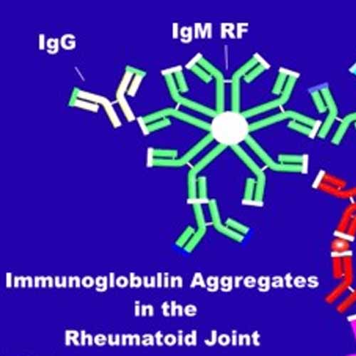 Rheumatoid Factor