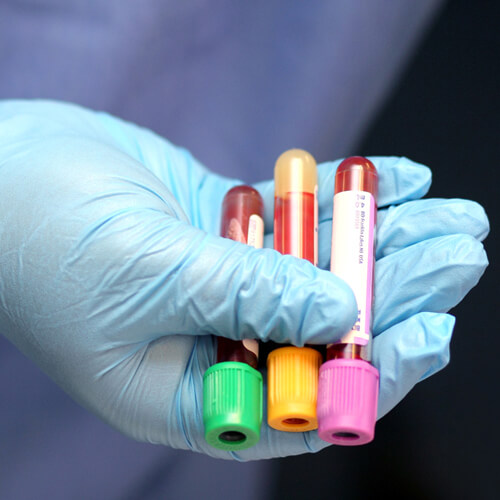 Comprehensive Thyroid Wellness Panel