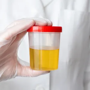 Urine ETG
