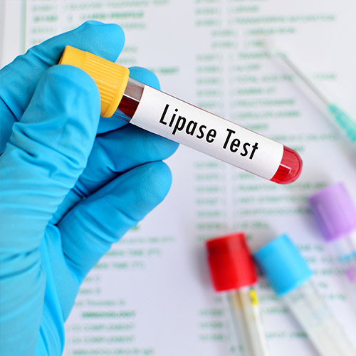 Lipase